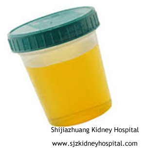 How to Treat Proteinuria Caused by Membranous Nephropathy