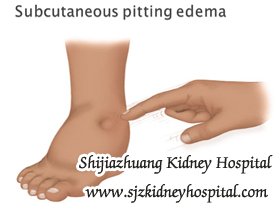 Treatments of Severe Edema in Hypertensive Nephropathy