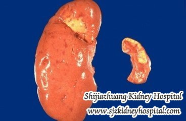 Once Kidney is Shrunk Can It Grow Back to Original Size