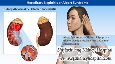 Alport Syndrome and the Treatment of It