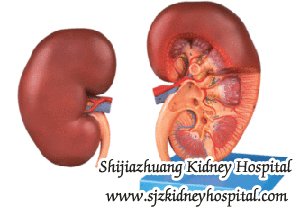 Early Diagnosis and Treatment of Chronic Kidney Disease can Prevent Kidney Failure