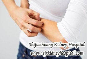 Can Chronic Kidney Disease Patient Get Itchy Rash in Stage 3