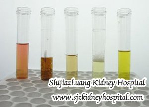 Blood Urine in Polycystic Kidney Disease How to Treat It