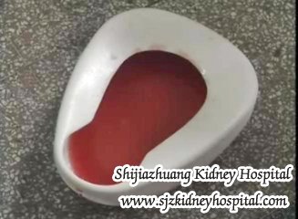 Polycystic Kidney Disease with Blood Urine How to Treat It