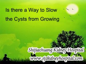 Is there a Way to Slow the Cysts from Growing or Treatment to Shrink Cysts