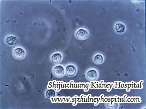 Infection in Dialysis What is the Reason and How to Deal It