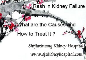 Rash in Kidney Failure What are the Causes and How to Treat It