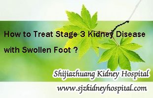 How to Treat Stage 3 Kidney Disease with Swollen Foot