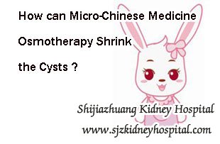 How can Micro-Chinese Medicine Osmotherapy Shrink the Cysts