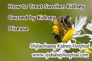 How to Treat Swollen Kidney Caused by Kidney Disease
