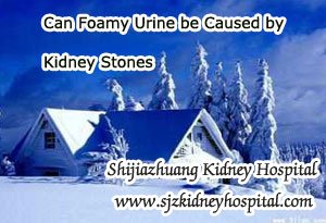 Can Foamy Urine be Caused by Kidney Stones