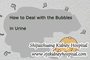 How to Deal with the Bubbles in Urine