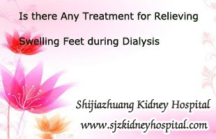 Is there Any Treatment for Relieving Swelling Feet during Dialysis