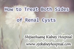 How to Treat Both Sides of Renal Cysts