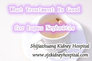 What Treatment Is Good for Lupus Nephritis