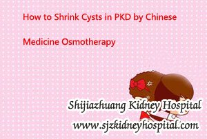 How to Shrink Cysts in PKD by Chinese Medicine Osmotherapy