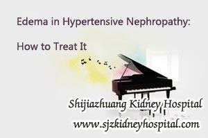 Edema in Hypertensive Nephropathy: How to Treat It