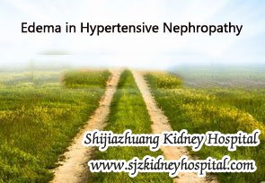 Edema in Hypertensive Nephropathy