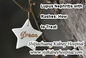 Lupus Nephritis with Rashes: How to Treat