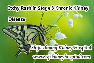 Itchy Rash in Stage 3 Chronic Kidney Disease