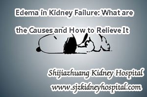 Edema in Kidney Failure: What are the Causes and How to Relieve It