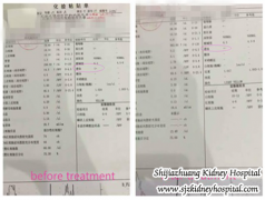 Nephritis Patient Got Her Disease Under Control