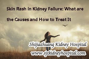 Skin Rash in Kidney Failure: What are the Causes and How to Treat It