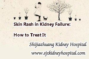 Skin Rash in Kidney Failure: How to Treat It