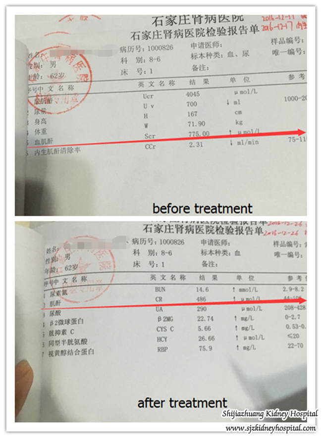 Diabetes with Creatinine 775 Can be Controlled by Chinese Medicine