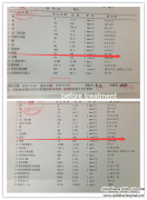 Serum Creatinine Downs to 469 from 766 in 6 Days