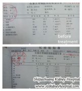 High Creatinine Level in Diabetic Nephropathy Downs to Lower Level