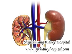 What are Symptoms of Chronic Kidney Disease