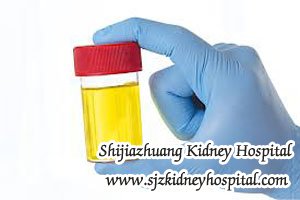 Does Bubbles in Urine Mean Diabetic Nephropathy