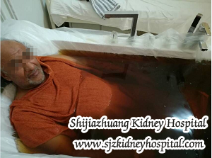 Is Medicated Bath Helpful for Hypertensive Nephropathy Patients