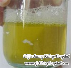 Are Bubbles in Urine An Index of IgA Nephropathy