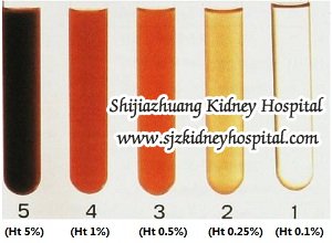 Is Blood in Urine An Indicatrix of Kidney Failure
