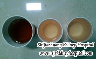 Is Blood in Urine An Index of Kidney Disease