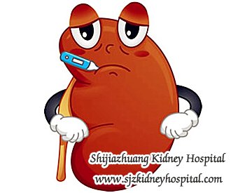 How to Dispel the Swelling in Legs for FSGS patients
