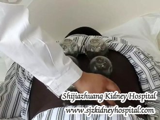 Is There Any Way to Reduce Cysts in Kidney Without Surgery