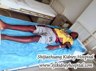 How to Settle the Hypertension for Chronic Nephritis Patients
