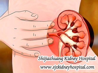 FSGS and Creatinine 5.8, How to Dispel Edema