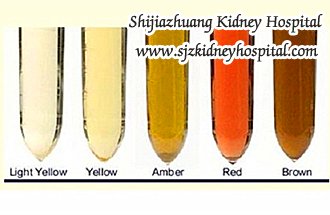 Hematuria and Creatinine 4.2, Can CKD be Cured
