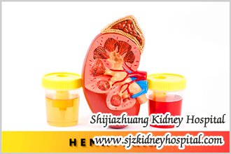 Is There Any Way to Treat Hematuria for FSGS Patients