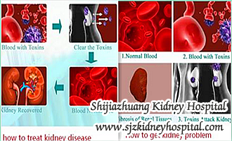 How Can You Help Me Get Rid of Edema with Creatinine 3.46