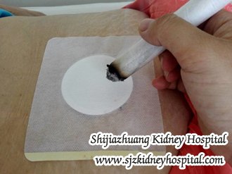 How to Improve Kidney Function in the Condition of Kidney Failure