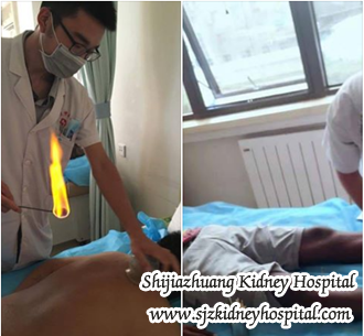 reduce creatinine 9.2, without dialysis, kidney treatment