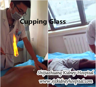What are Natural Treatment to FSGS Accompanied with Creatinine 400