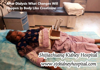 After Dialysis What Changes Will Happen In Body Like Creatinine