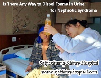 Is There Any Way to Dispel Foamy In Urine for Nephrotic Syndrome