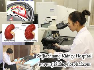 Creatinine 6.1, Would PKD Result in Elevation of Blood Pressure